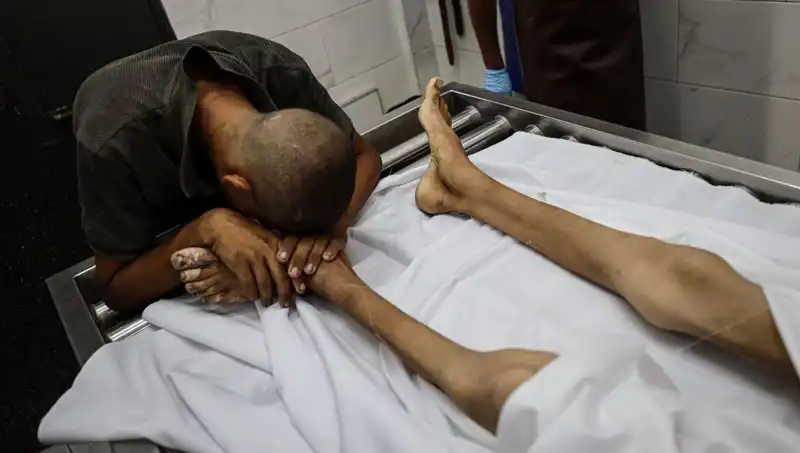 Gazze'de Çocukları Vuran Acı Gerçek: Açlık Felaketi