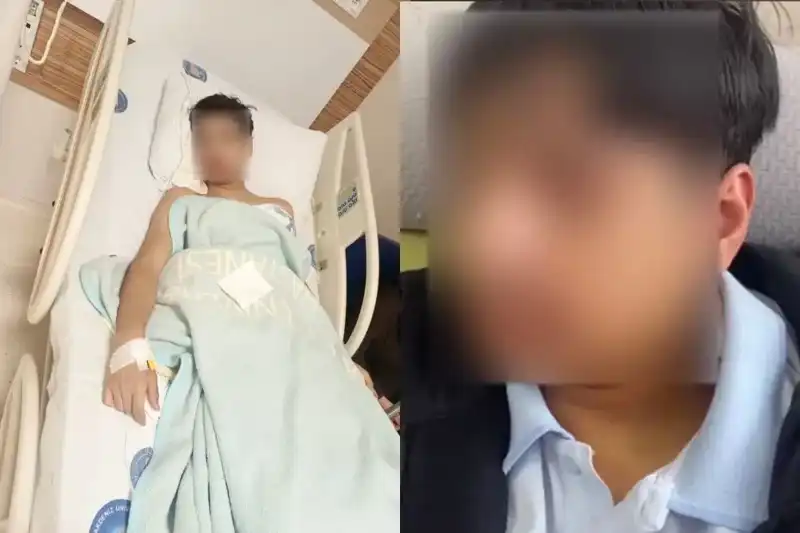 Antalya'da Şok Eden Olay: Arkadaşının Çenesini Kıran Genç